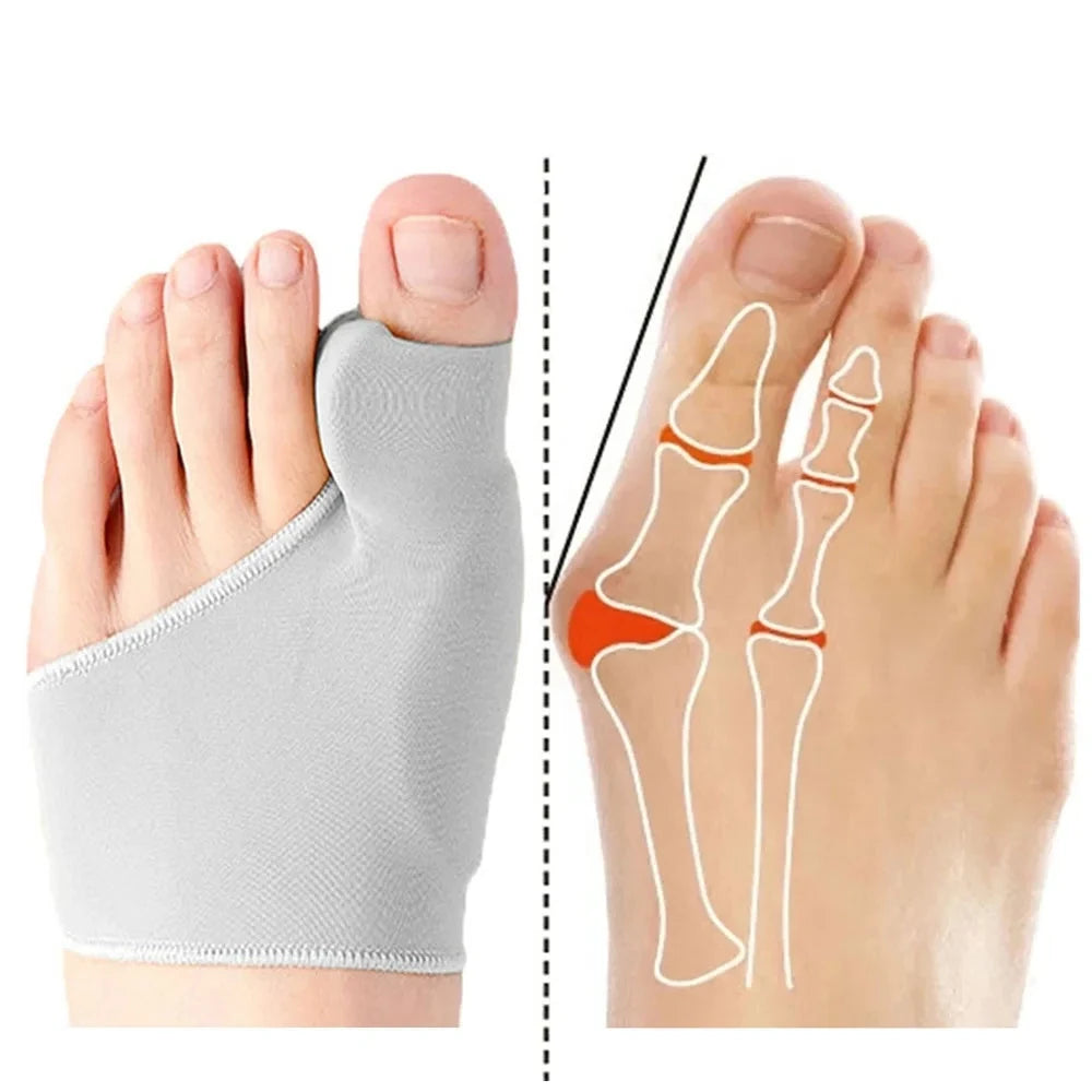 Hallux Valgus Zehenkorrektor – Elastischer Geradehalter für Fußkomfort & Zehenausrichtung